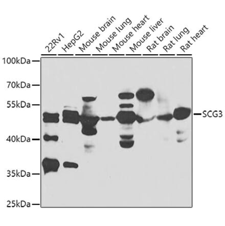 Western Blot - Anti-SCG3 Antibody (A7799) - Antibodies.com