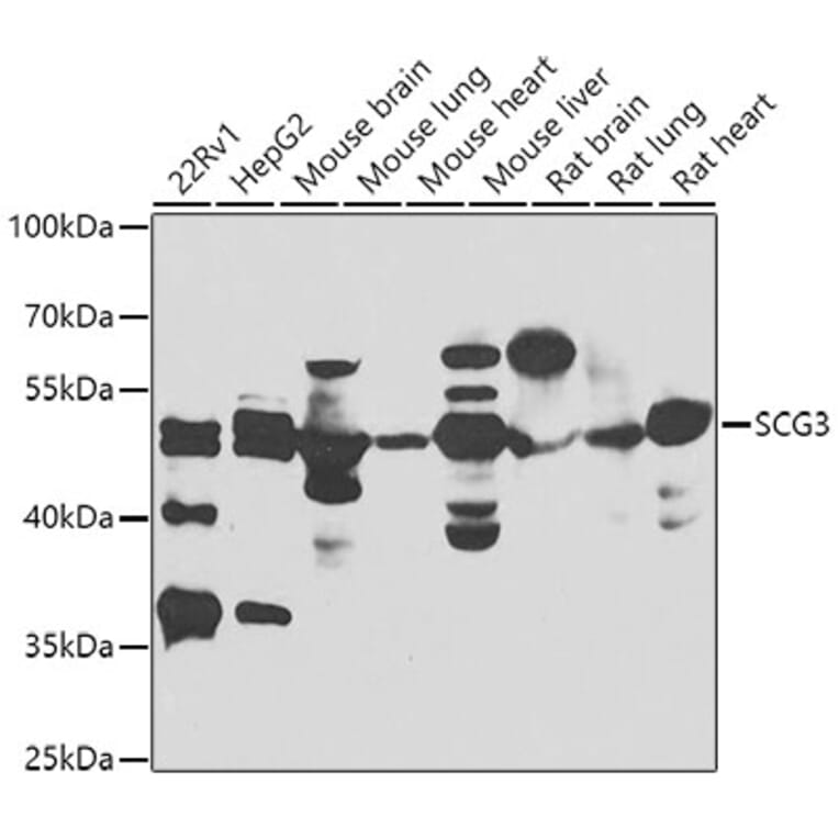 Western Blot - Anti-SCG3 Antibody (A7799) - Antibodies.com