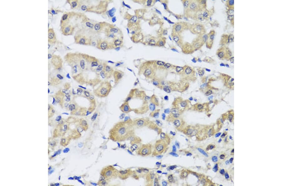 Immunohistochemistry - Anti-SCG3 Antibody (A7799) - Antibodies.com
