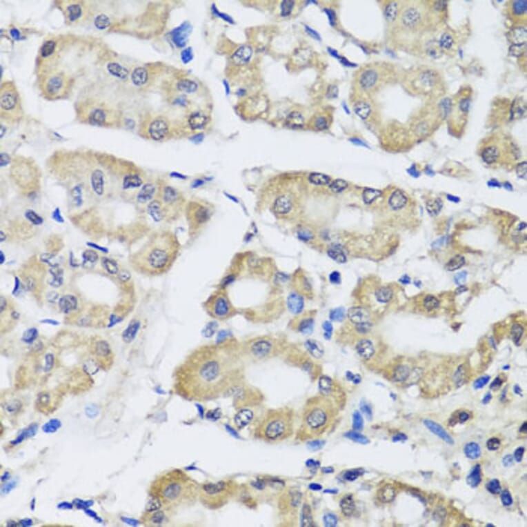 Immunohistochemistry - Anti-SCG3 Antibody (A7799) - Antibodies.com