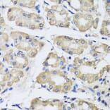Immunohistochemistry - Anti-SCG3 Antibody (A7799) - Antibodies.com