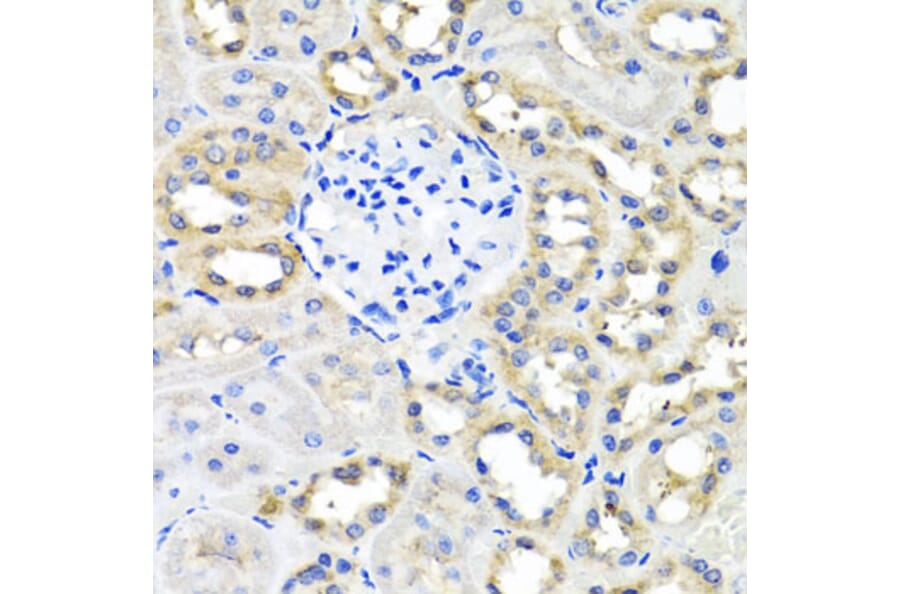 Immunohistochemistry - Anti-SCG3 Antibody (A7799) - Antibodies.com