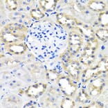 Immunohistochemistry - Anti-SCG3 Antibody (A7799) - Antibodies.com