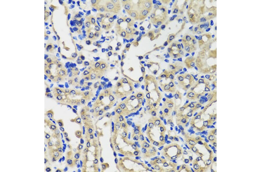 Immunohistochemistry - Anti-SCG3 Antibody (A7799) - Antibodies.com