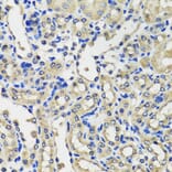 Immunohistochemistry - Anti-SCG3 Antibody (A7799) - Antibodies.com