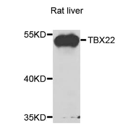 Western Blot - Anti-TBX22 Antibody (A7801) - Antibodies.com