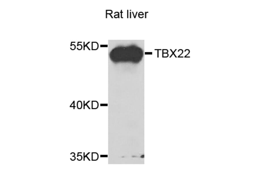 Western Blot - Anti-TBX22 Antibody (A7801) - Antibodies.com