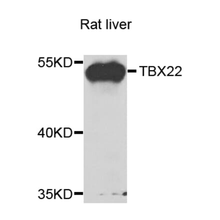 Western Blot - Anti-TBX22 Antibody (A15904) - Antibodies.com