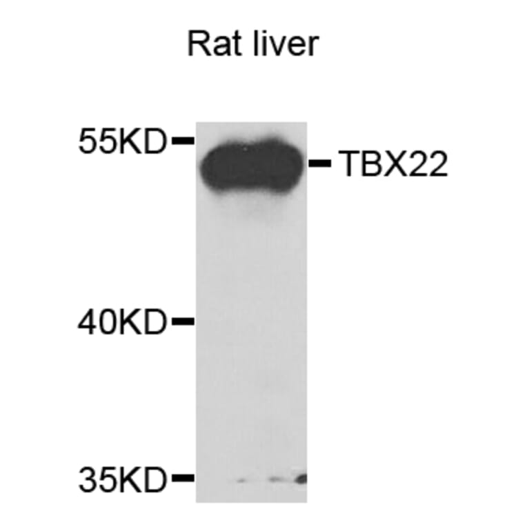 Western Blot - Anti-TBX22 Antibody (A7801) - Antibodies.com