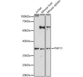 Western Blot - Anti-PHF11 Antibody (A15905) - Antibodies.com