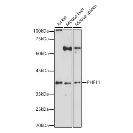 Western Blot - Anti-PHF11 Antibody (A15905) - Antibodies.com