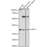Western Blot - Anti-PHF11 Antibody (A15905) - Antibodies.com