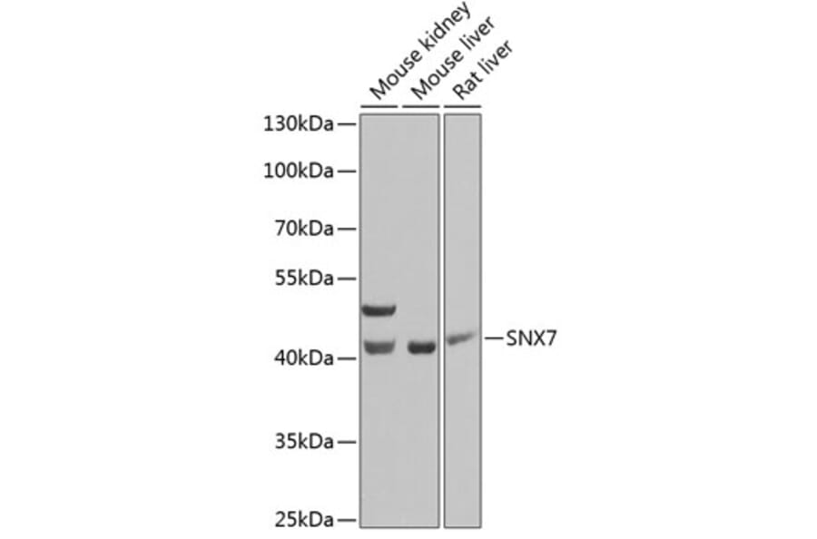 Western Blot - Anti-SNX7 Antibody (A15906) - Antibodies.com