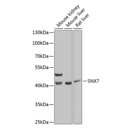 Western Blot - Anti-SNX7 Antibody (A15906) - Antibodies.com