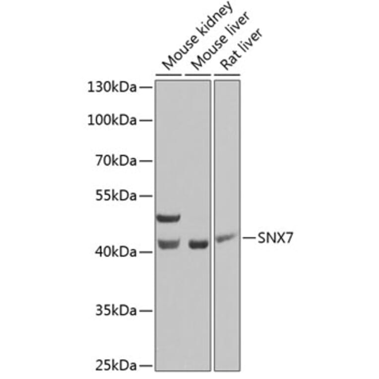Western Blot - Anti-SNX7 Antibody (A15906) - Antibodies.com