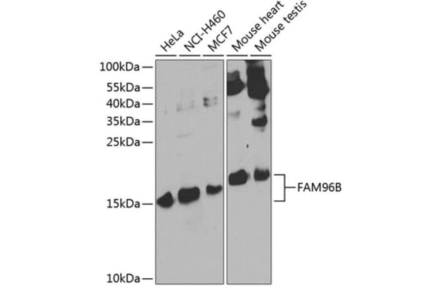 Western Blot - Anti-FAM96B Antibody (A15907) - Antibodies.com