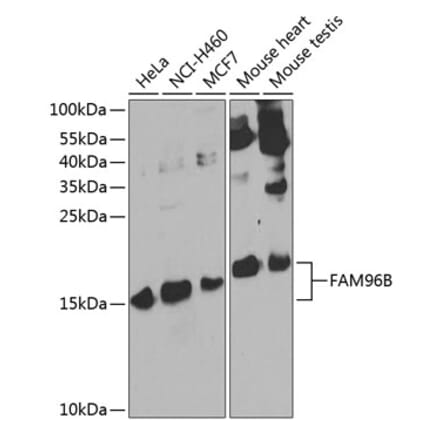 Western Blot - Anti-FAM96B Antibody (A15907) - Antibodies.com