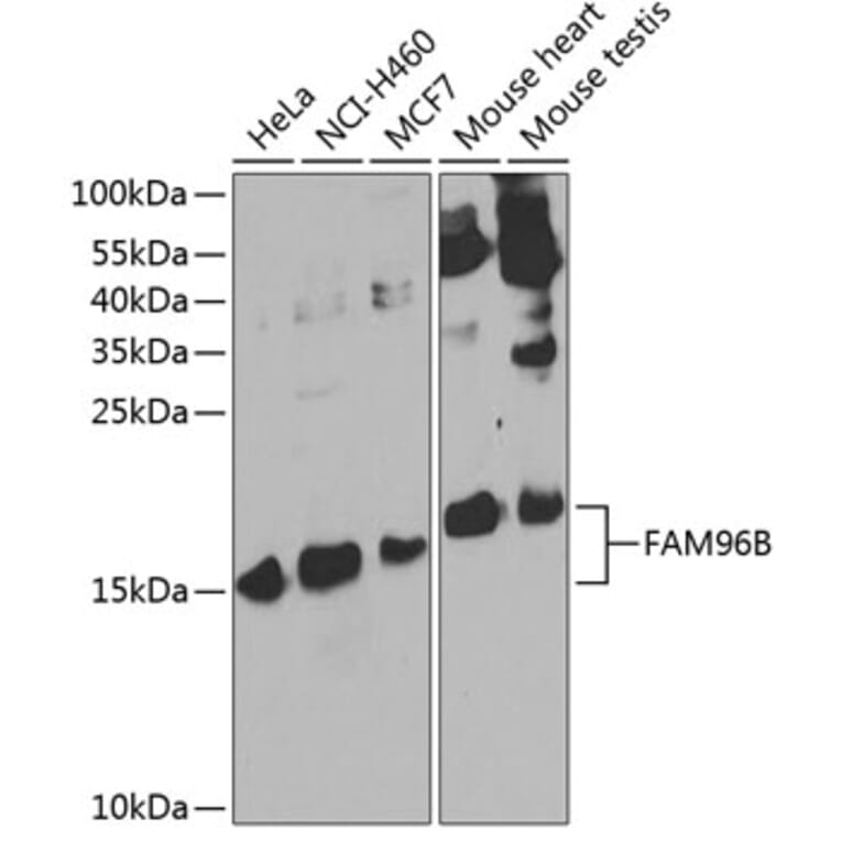 Western Blot - Anti-FAM96B Antibody (A15907) - Antibodies.com