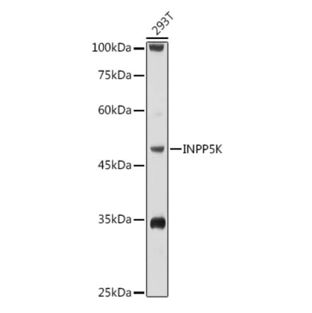 Western Blot - Anti-SKIP Antibody (A15908) - Antibodies.com