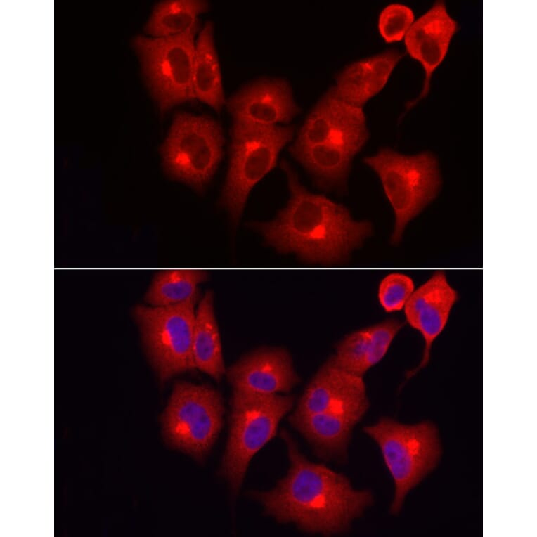 Immunofluorescence - Anti-SKIP Antibody (A15908) - Antibodies.com