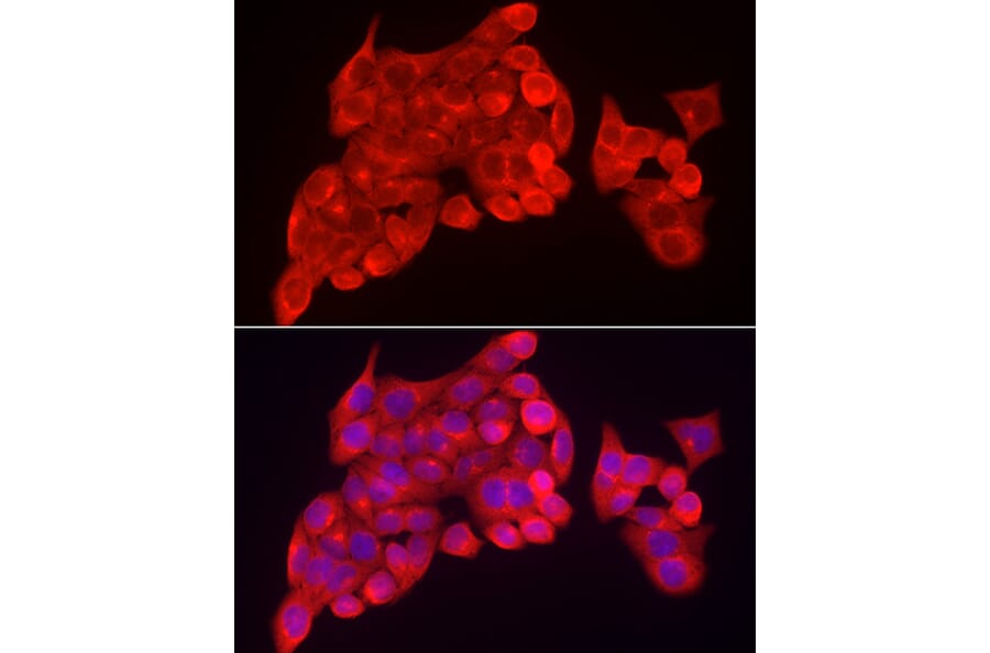 Immunofluorescence - Anti-SKIP Antibody (A15908) - Antibodies.com