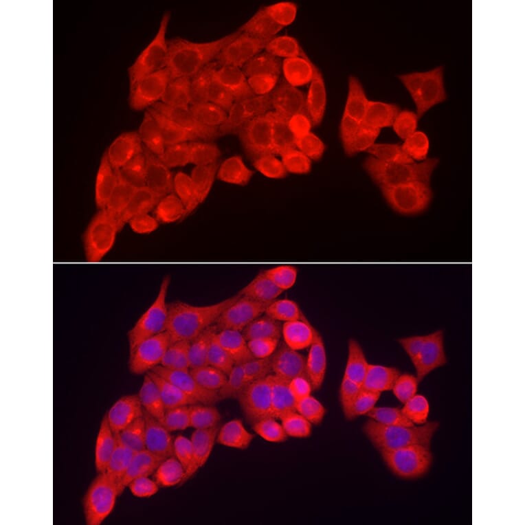 Immunofluorescence - Anti-SKIP Antibody (A15908) - Antibodies.com