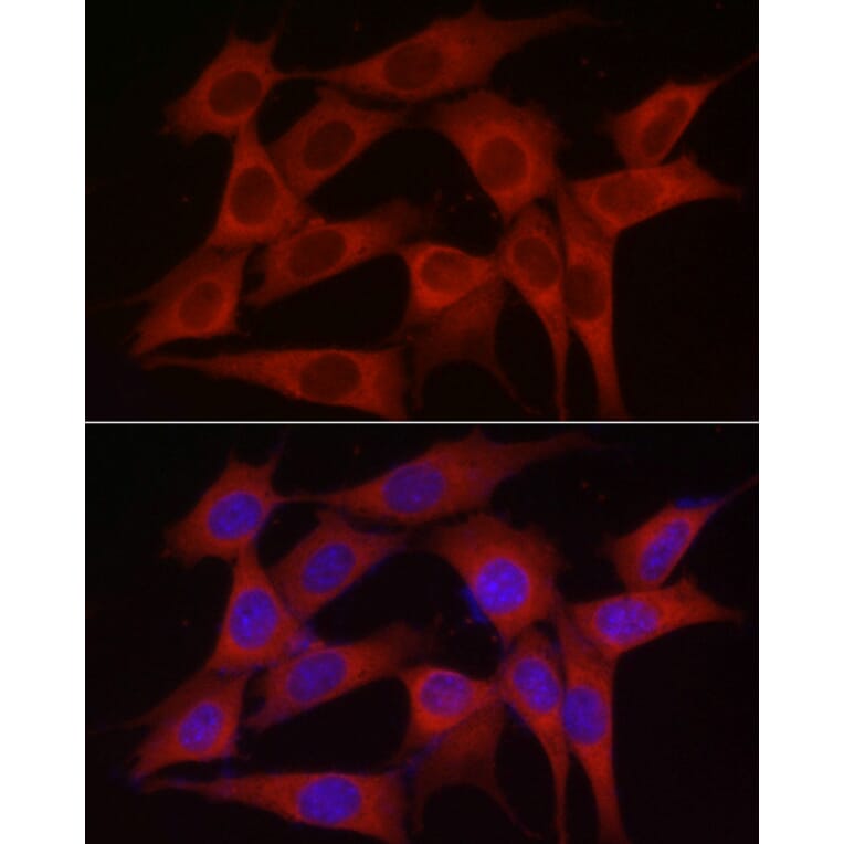 Immunofluorescence - Anti-SKIP Antibody (A15908) - Antibodies.com