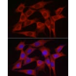 Immunofluorescence - Anti-SKIP Antibody (A15908) - Antibodies.com
