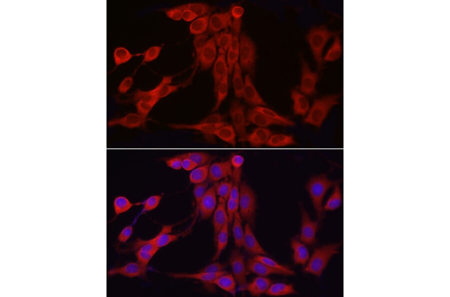 Immunofluorescence - Anti-SKIP Antibody (A15908) - Antibodies.com