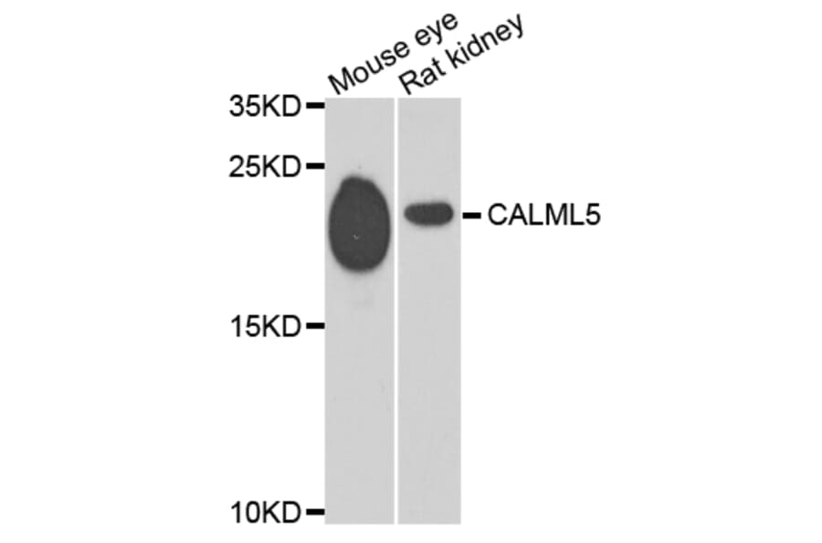 Western Blot - Anti-CALML5 Antibody (A7808) - Antibodies.com