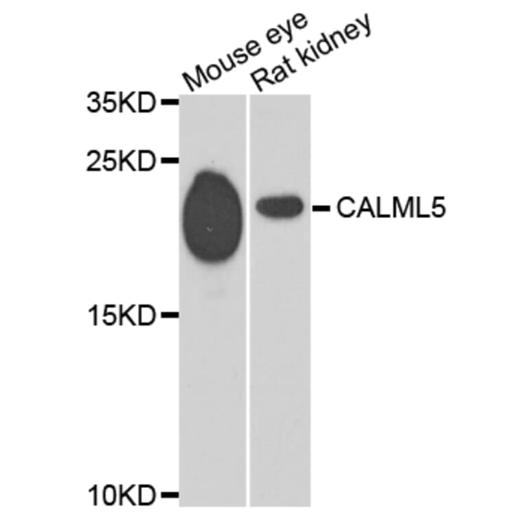 Western Blot - Anti-CALML5 Antibody (A7808) - Antibodies.com