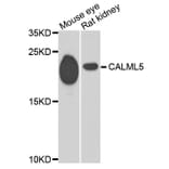 Western Blot - Anti-CALML5 Antibody (A7808) - Antibodies.com