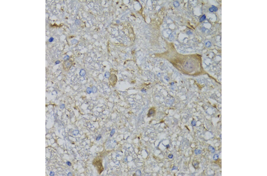 Immunohistochemistry - Anti-CALML5 Antibody (A7808) - Antibodies.com