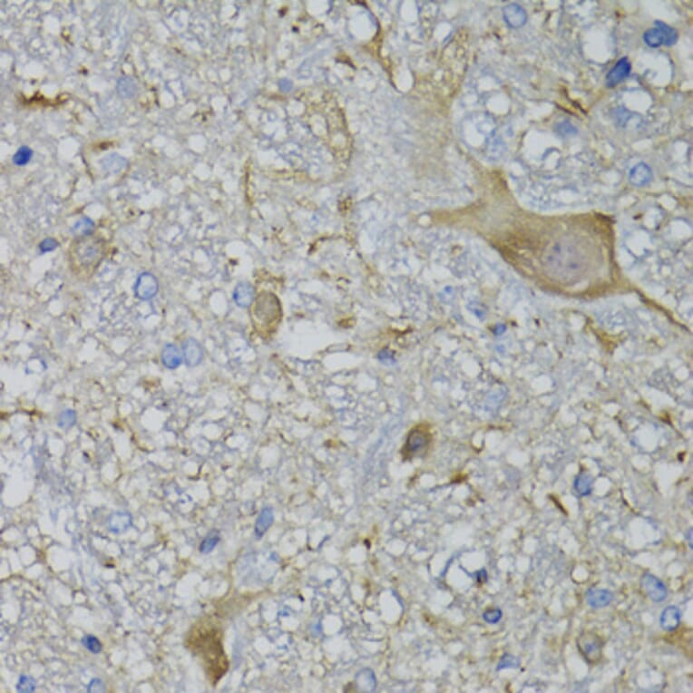 Immunohistochemistry - Anti-CALML5 Antibody (A7808) - Antibodies.com