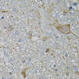 Immunohistochemistry - Anti-CALML5 Antibody (A7808) - Antibodies.com