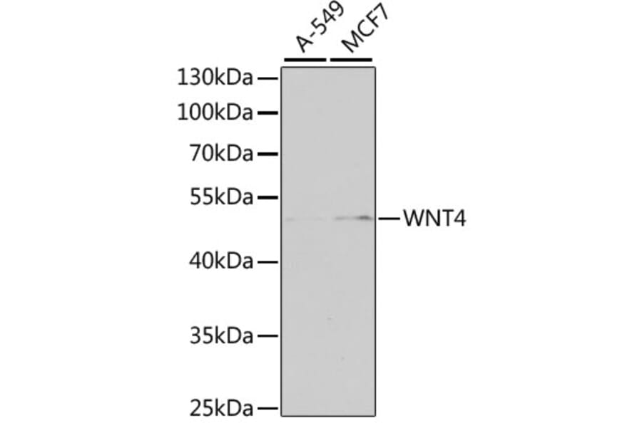 Western Blot - Anti-Wnt4 Antibody (A15910) - Antibodies.com
