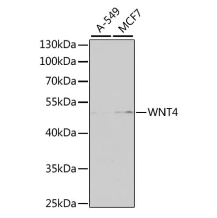 Western Blot - Anti-Wnt4 Antibody (A15910) - Antibodies.com