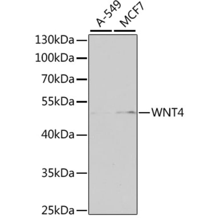 Western Blot - Anti-Wnt4 Antibody (A15910) - Antibodies.com