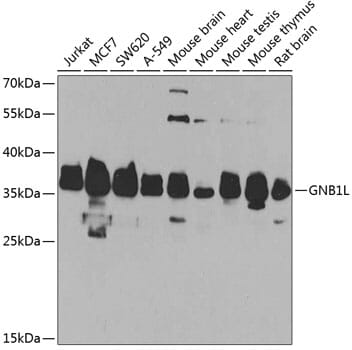 Western blot analysis of extracts of various cell lines, using Anti-GNB1L Antibody (A7810) at 1:1,000 dilution.
Secondary antibody: Goat Anti-Rabbit IgG (H+L) (HRP) (AS014) at 1:10,000 dilution.
Lysates / proteins: 25µg per lane.
Blocking buffer: 3% non-fat dry milk in TBST.
Detection: ECL Basic Kit (RM00020).
Exposure time: 90s.