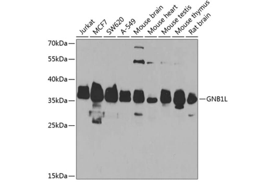Western Blot - Anti-GNB1L Antibody (A15911) - Antibodies.com