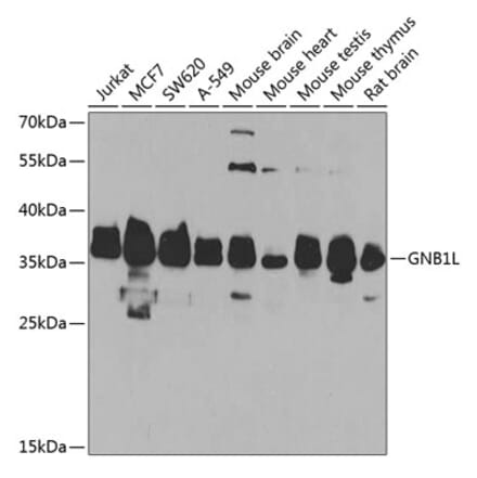 Western Blot - Anti-GNB1L Antibody (A15911) - Antibodies.com