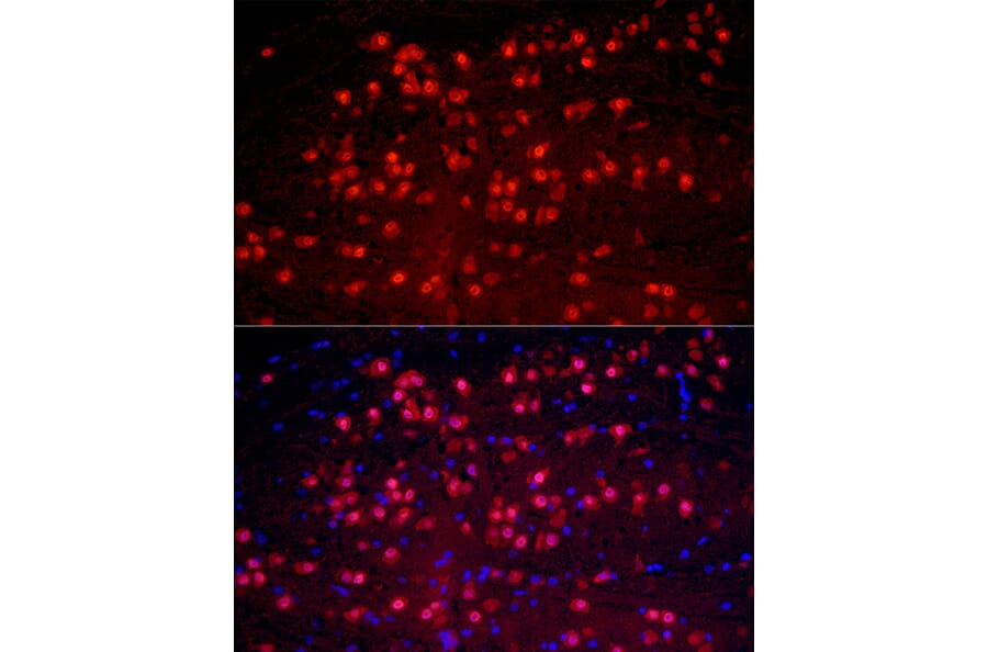 Immunofluorescence - Anti-A2BP1/Fox1/RBFOX1 Antibody (A15912) - Antibodies.com