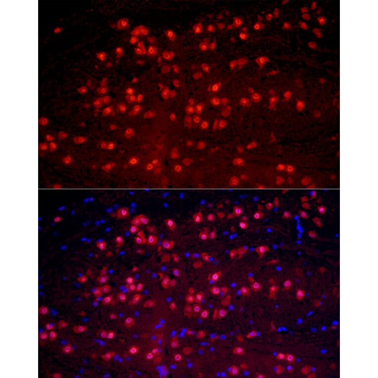 Immunofluorescence - Anti-A2BP1/Fox1/RBFOX1 Antibody (A15912) - Antibodies.com