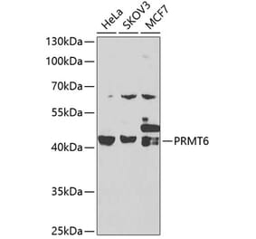 Western Blot - Anti-PRMT6 Antibody (A15913) - Antibodies.com
