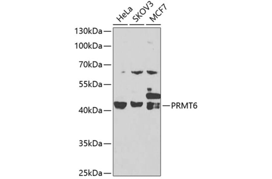 Western Blot - Anti-PRMT6 Antibody (A15913) - Antibodies.com