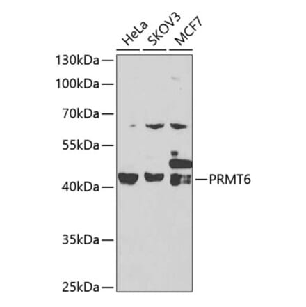 Western Blot - Anti-PRMT6 Antibody (A15913) - Antibodies.com