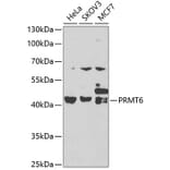 Western Blot - Anti-PRMT6 Antibody (A15913) - Antibodies.com