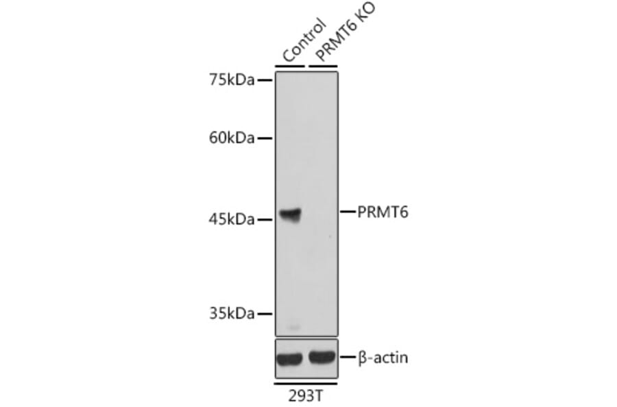 Western Blot - Anti-PRMT6 Antibody (A15913) - Antibodies.com