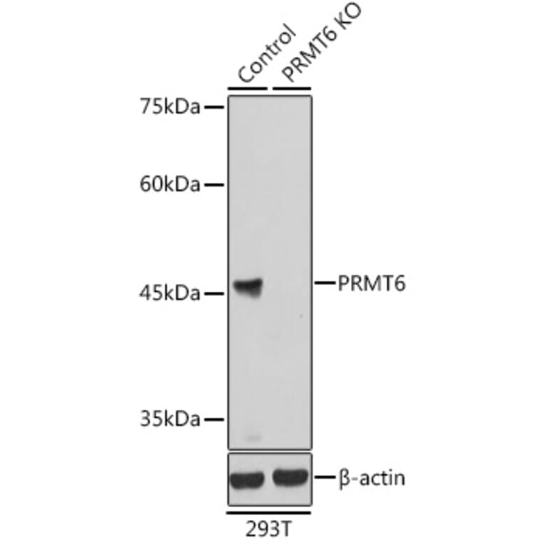 Western Blot - Anti-PRMT6 Antibody (A15913) - Antibodies.com
