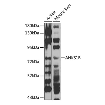 Western Blot - Anti-ANKS1B Antibody (A15915) - Antibodies.com